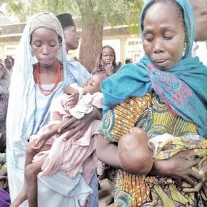 malnutrition children