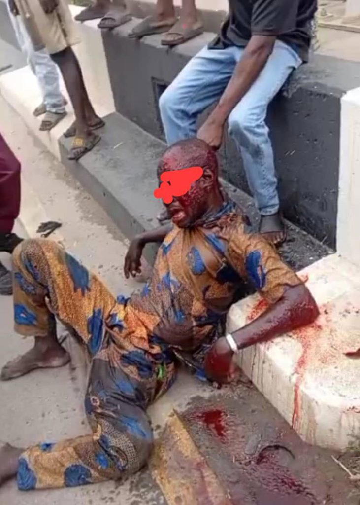 LASTMA nabs Togolese driver after speed-Induced crash on Lagos Island