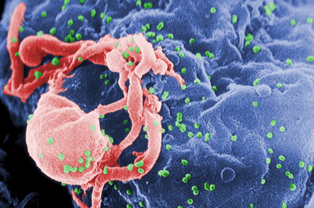 Adamawa records 8,850 new HIV infections in 4 years – Official