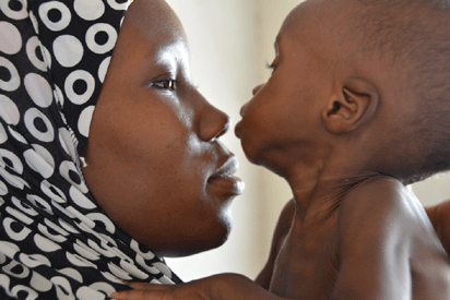 unicef.gif Poor nutrition is weakening children’s bones- Nutritionist