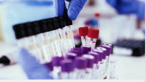 FG orders mandatory drug testing for public service applicants